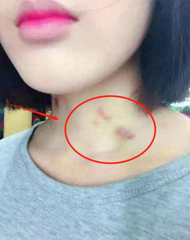 男人迈开腿尝尝你的草莓-第3张图片