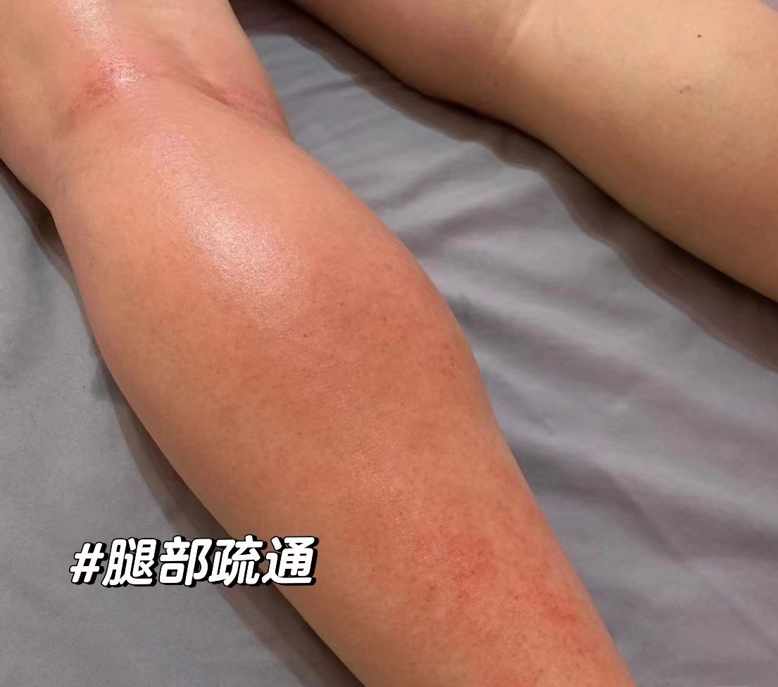 把腿开到最大就不疼把腿开到最大就不疼，一种神奇的体验