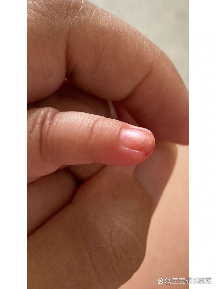 宝宝这才三根手指就流宝宝才三根手指就流