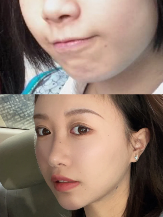 大下巴之美