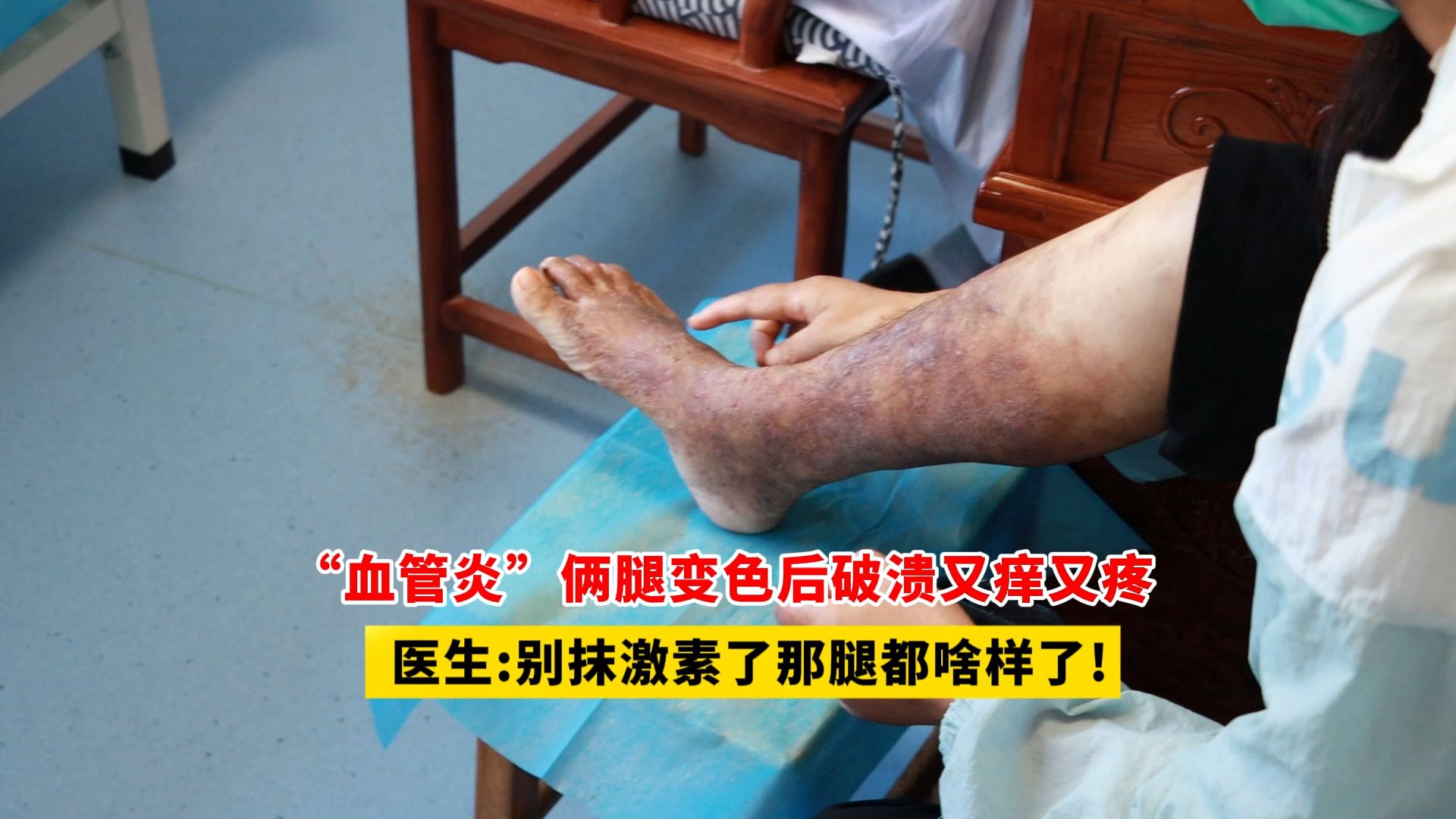 淑娟两腿间又痒了淑娟两腿间又痒了-第3张图片
