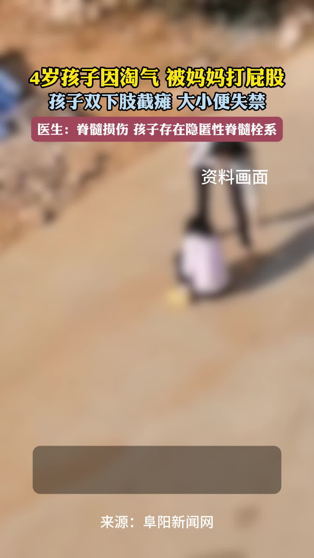 打屁股视频趴着现代派现代派打屁股视频，趴着的启示-第2张图片
