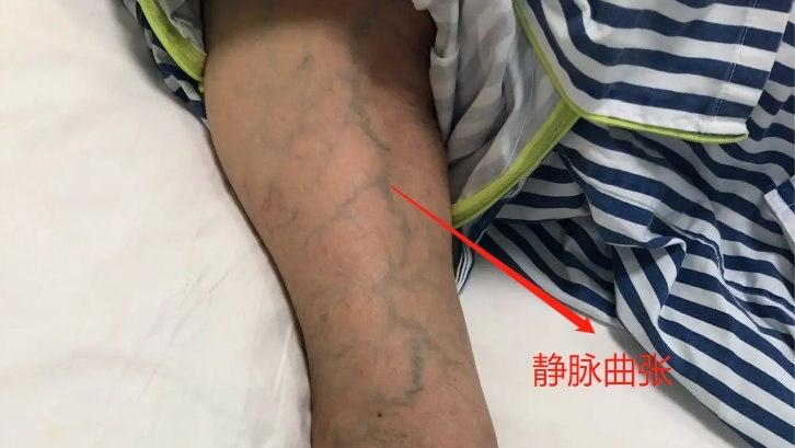 两条蛇根太大了涨的疼-第3张图片