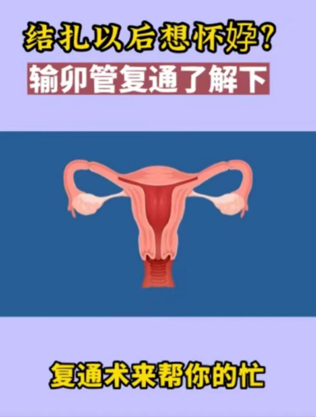 妈妈结扎了可以干吗妈妈结扎了可以干什么-第2张图片