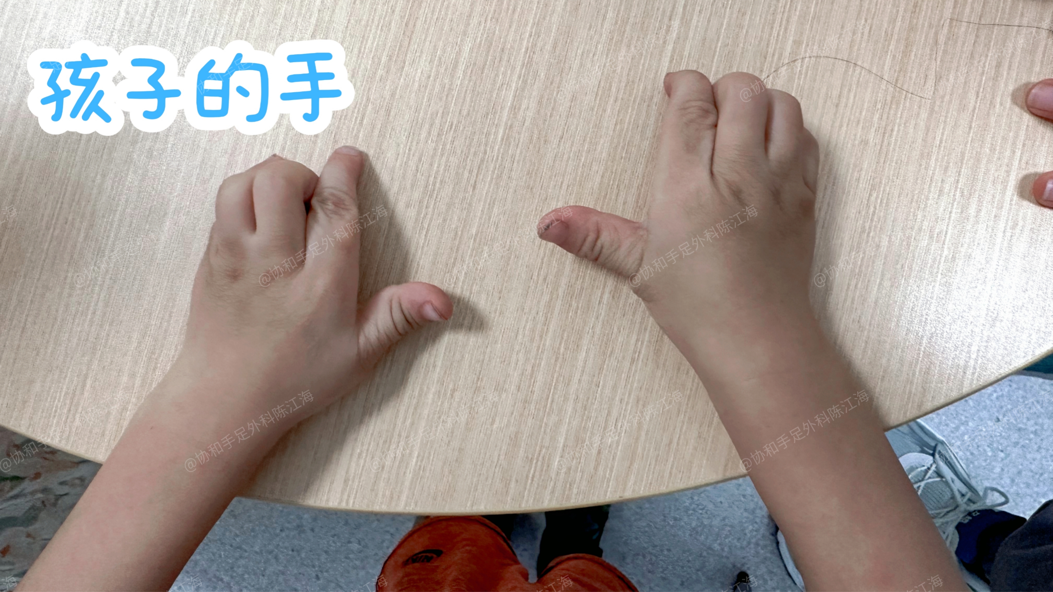 才三根手指就成这样了才三根手指就成这样了-第3张图片