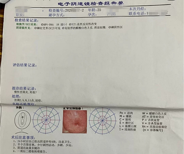 长日光阴hpv18奶头被改造长日光阴HPV18，健康与生活的双重挑战-第1张图片