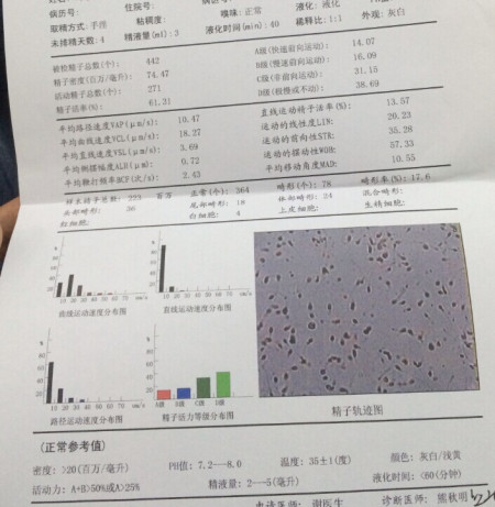 女同桌把我的精子弄出来了怎么办女同桌弄出精子事件，如何应对与处理-第2张图片